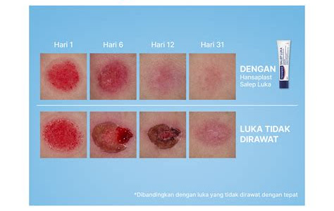 Gambar Luka Teruk Terperinci: Kenalpasti Punca dan Rawatannya!