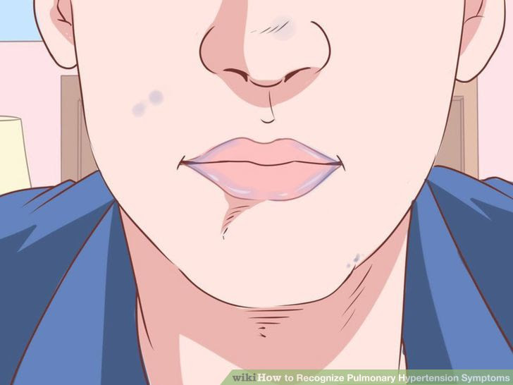Recognize Pulmonary Hypertension Symptoms Step 4.jpg