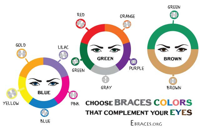 You Don't Have to Be a Genius to Choose Braces Colors