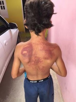 Menino foi agredido em Jacobina (Foto: Augusto Urgente)