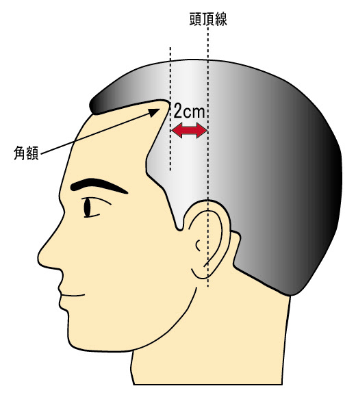 おでこの広さの基準とは 指での正しい測り方やハゲの基準を詳しく説明