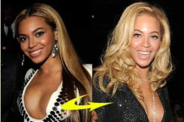 Do Celebrities Bleach their Skin – Secretes, Tips, Treatments, Pills 