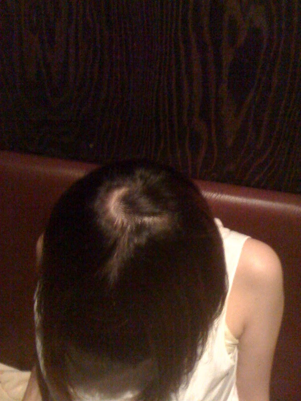 五月女 圭一の走り方 Blog Archive つむじが2個