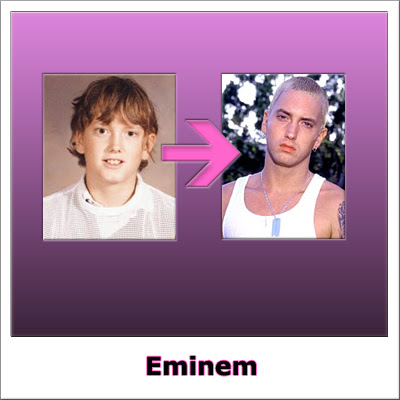 eminem plastic surgery