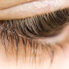 Eyelash Mites - Are Your Demodex Eyelash Mites Out of Control?Eyelash Mites - Washing can rid eyelashes of mites - Taipei Times