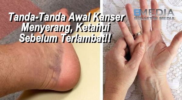 Jangan Abaikan Info Ini..20 Tanda-tanda Awal Kanser Menyerang, Ketahui Sebelum Terlambat.