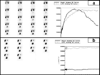 Buy Ventolin without a prescription — What is Ventolin >>