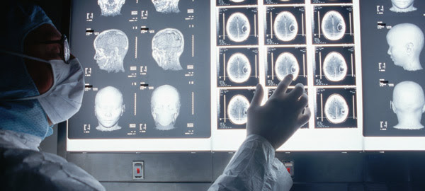 “El cerebro femenino está activo el 90% del tiempo, el masculino tan sólo un 9%”
