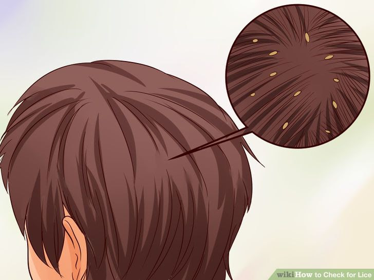 Check for Lice Step 7 Version 2.jpg