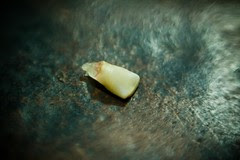 Tooth