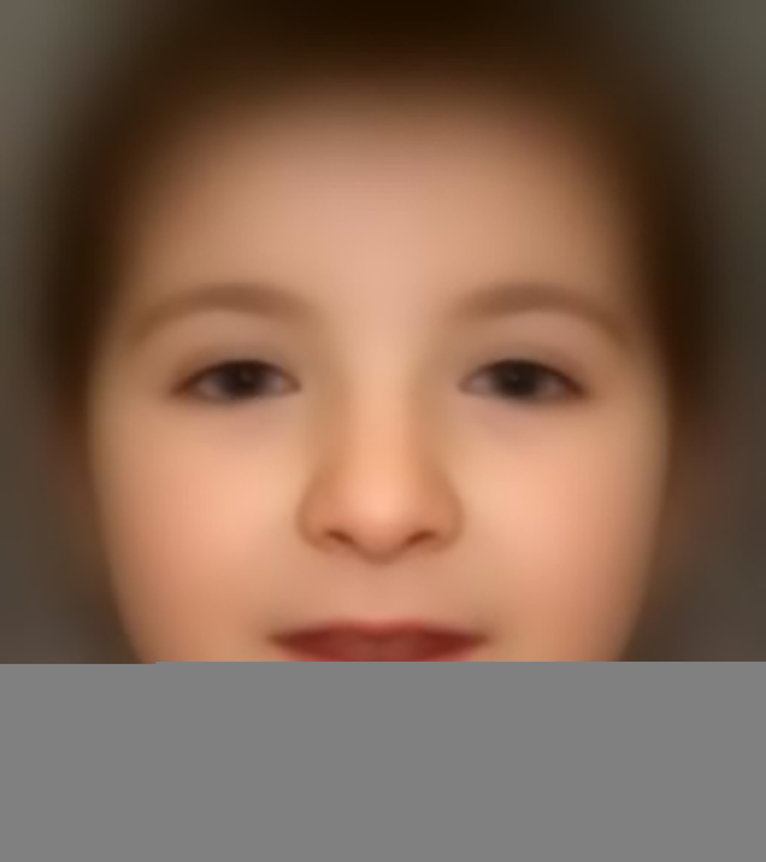 Rubinstein Taybi Syndrome Omim 180849 Fdna