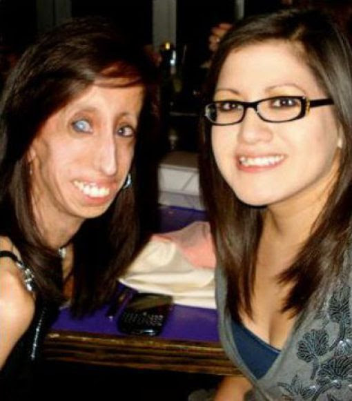 The Story of 21-year-old Lizzie Velasquez (17 pics) The Story of 21-year-old Lizzie Velasquez (17 pics)