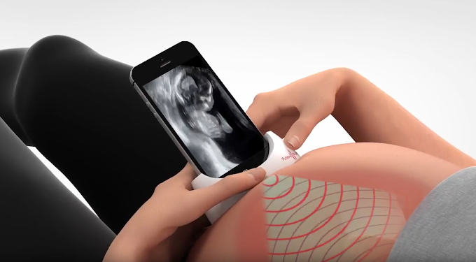 PulseNmore At-Home Tele-Ultrasound for Pregnant Women