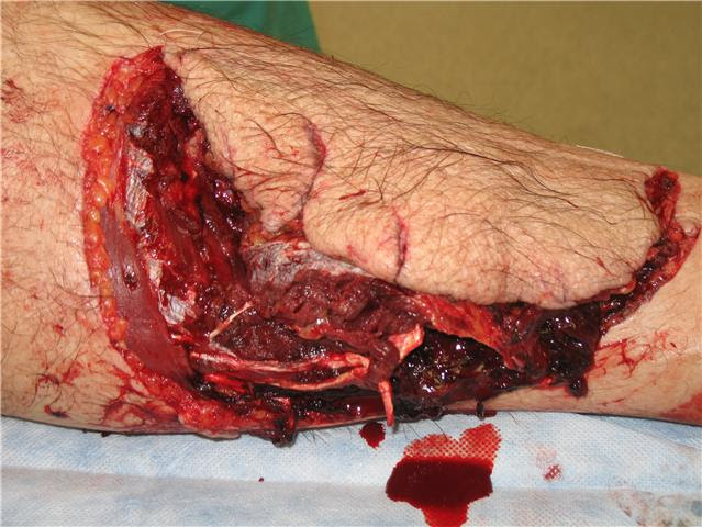 shark bite drink. nibble Shark bite. reply