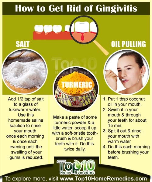 Home remedies for gingivitis - Cyclicmint