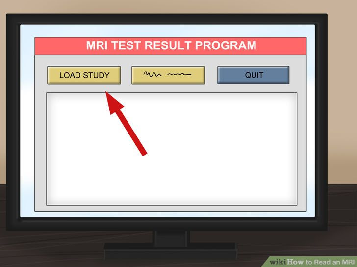 Read an MRI Step 4 Version 2.jpg