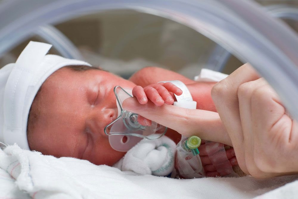 Cerebral Palsy from Neonatal Encephalopathy (NE) | Michigan Cerebral