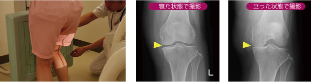 膝の専門検査 福岡リハビリテーション病院 福岡リハ整形外科クリニック 福岡市西区 オンライン診療受付中福岡リハビリテーション病院 福岡リハ整形外科クリニック 福岡市西区 オンライン診療受付中