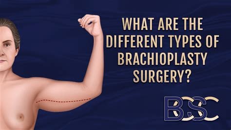 PDF Bilateral Brachioplasty Manual Guide