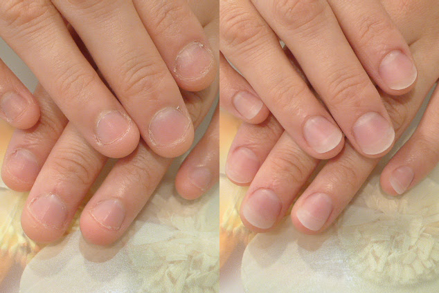 深爪矯正専門ネイルサロン Rifareリファーレ東京