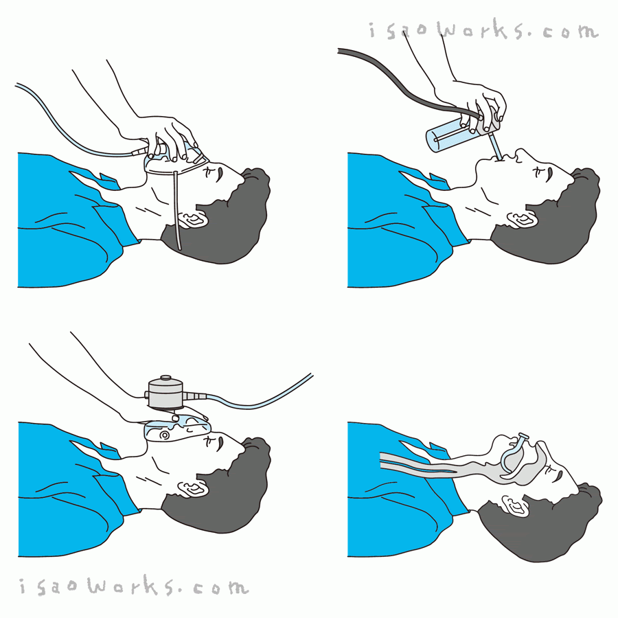 人工呼吸器の使い方と救命救急処置 カット 横川功の仕事置場