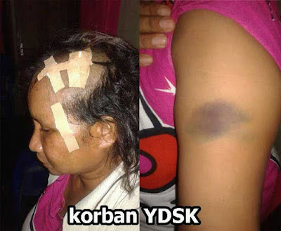 Ambon, Malukupost.com - Kinerja berlawanan dipertontonkan aparat kepolisian di lingkup Kepolisian Daerah Maluku. Buktinya jika aparat Kepolisian Resort (Polres) Pulau Ambon dan Pulau-pulau Ambon, Jumat (6/1/2017) sukses meringkus Wily Picauly, salah satu dari beberapa pelaku pembacokan terhadap tukang becak Syaiful Sella di Gang Da Silva Mardika, Kota Ambon, Kamis (5/1). Di sisi lain penyidik Kepolisian Sektor (Polsek) Nusaniwe justru membebaskan Arthur alias Oyang Manuata,23 tahun, pelaku tunggal perencanaan pembunuhan dan penganiayaan berat terhadap Yuliana Damaris Salmon Katipana (YDSK), 40, warga RT 008/RW 007 Gunung Nona, Kelurahan Benteng, Kecamatan Nusaniwe, Kota Ambon, pada Minggu, 25 Desember 2016, sekitar pukul 15.00 WIT. Anehnya, tanpa kesepakatan damai dengan korban YDSK atau keluarga besar korban, penyidik Polsek Nusaniwe membebaskan pelaku Arthur alias Oyang Manuata sehari setelah kejadian tersebut dengan alasan pelaku adalah anak piara dari LL yang merupakan mantan Kapolsek Nusaniwe yang dicopot jabatannya karena terseret kasus persetubuhan anak di bawah umur beberapa tahun lalu di Ambon, Maluku. 