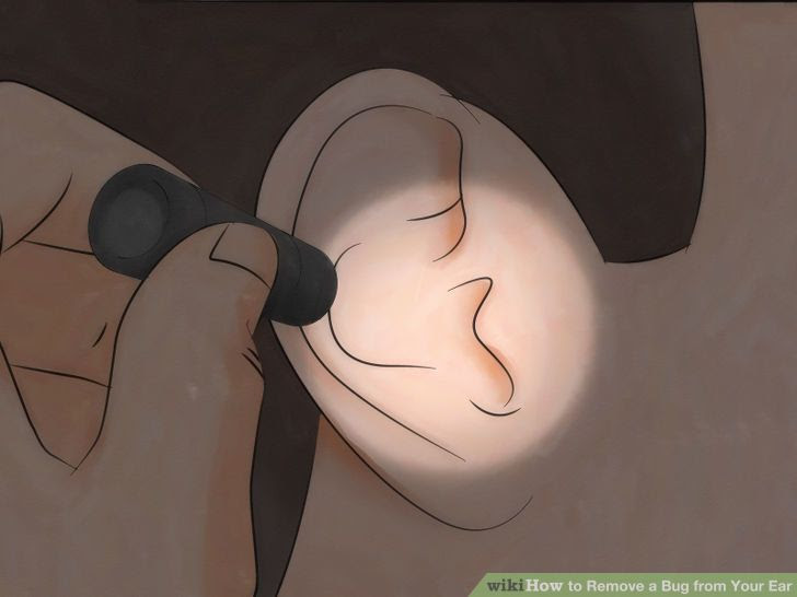 Remove a Bug from Your Ear Step 4 Version 2.jpg