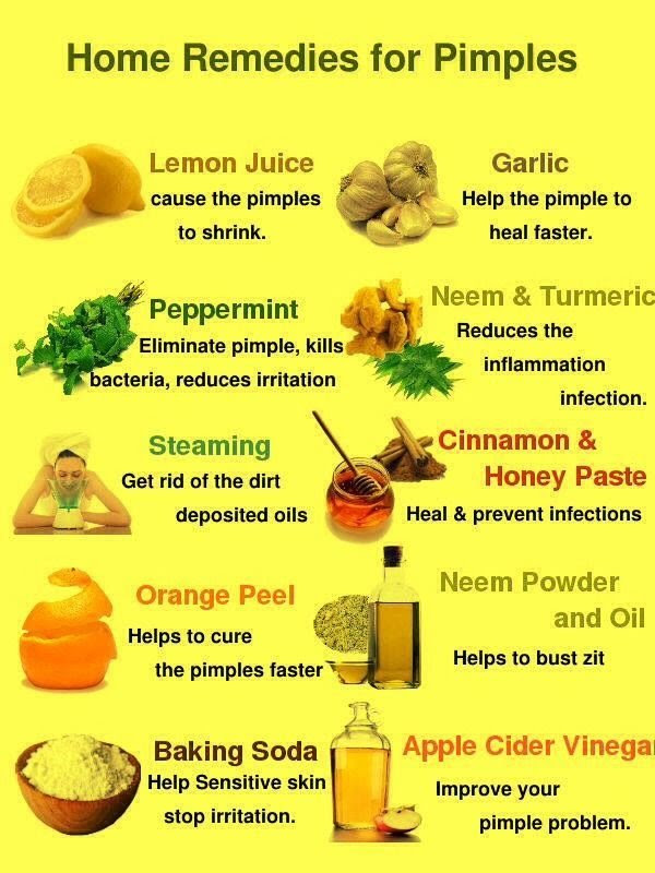 How to Get Rid of Pimples Overnight Home Remedies for
