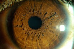 The Eye
