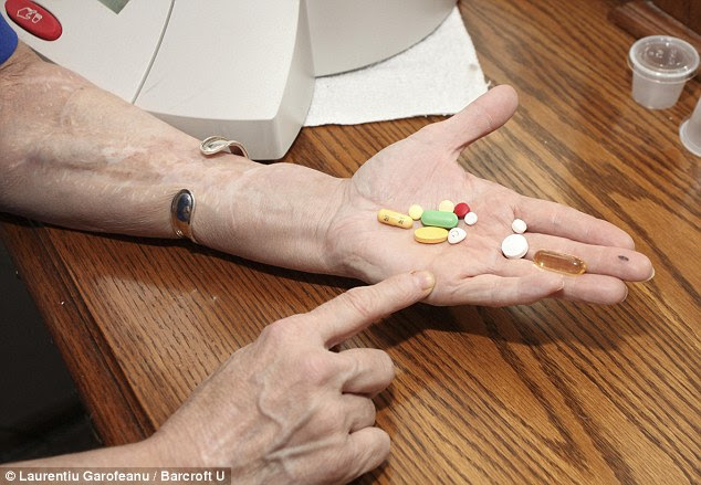But it's not easy: Ms Culp shows the cocktail of drugs she must take every day in order for her body not to reject her new face
