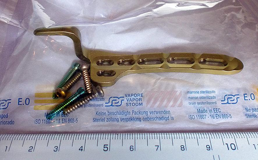 気ままに抜釘手術で一泊二日の入院