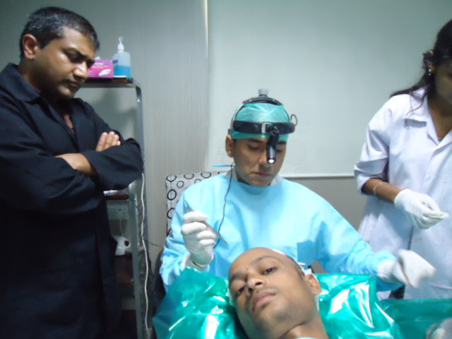 Hair Transplant Delhi NCR