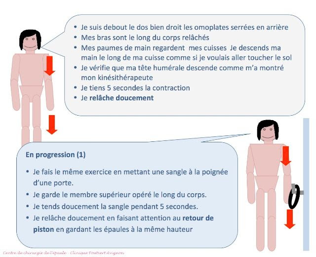 La Reeducation De L Epaule Apres Operation De La Coiffe Des Rotateurs Par L Unite De Chirurgie De L Epaule De La Clinique Capio Fontvert A Avignon Vaucluse 84 A Proximite De Carpentras Et Orange
