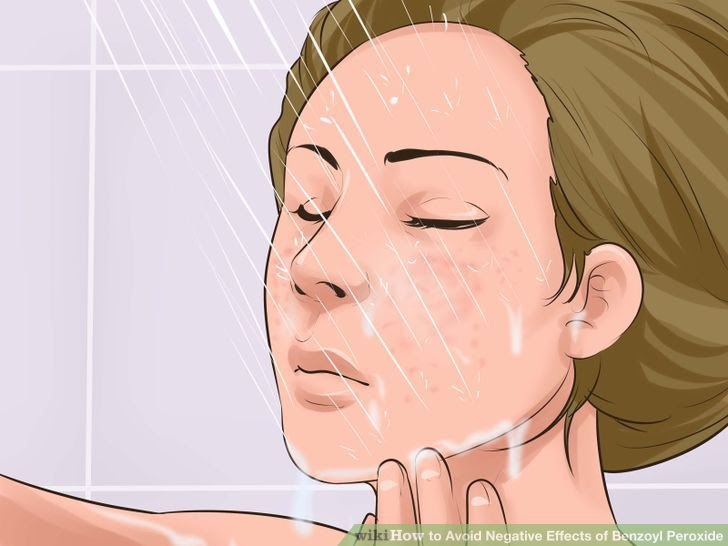 Avoid Negative Effects of Benzoyl Peroxide Step 10.jpg