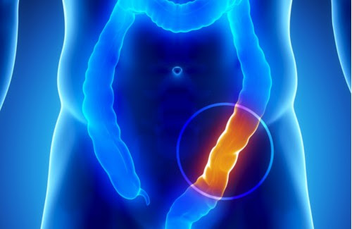 Most Excellent Como Limpiar El Colon 500 x 325 · 27 kB · jpeg