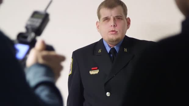 عملية زراعة الوجه الأكثر تعقيدا