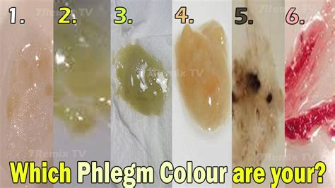  copd phlegm color chart