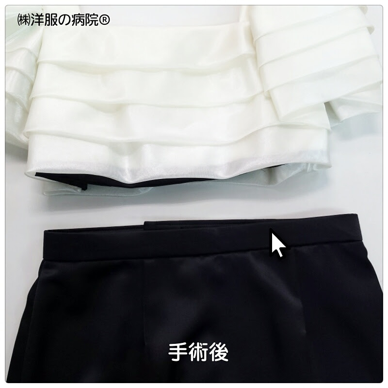 手術内容 ワンピースからスカートにリメイク 洋服の病院
