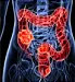 colon illustration