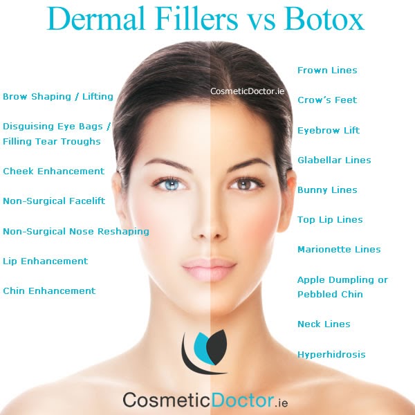 Skin Treatments Dublin / DÃ©colletage fixes at Castleknock Cosmetic Clinic Dublin â CastleknockSkin Treatments Dublin / Poikiloderma Redness | Reveal Smoother Skin with IPL Photorejuvenation