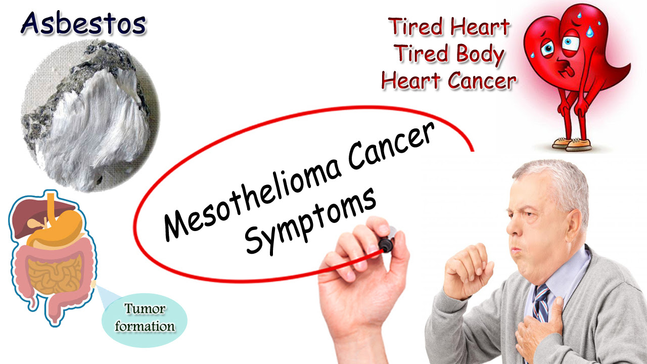 Mesothelioma cancer symptoms  moonlightforall.com