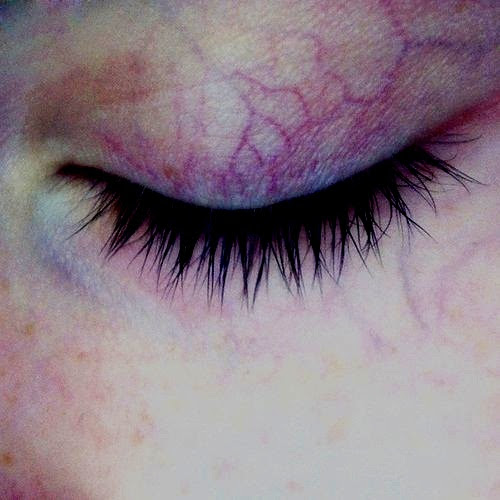Eye