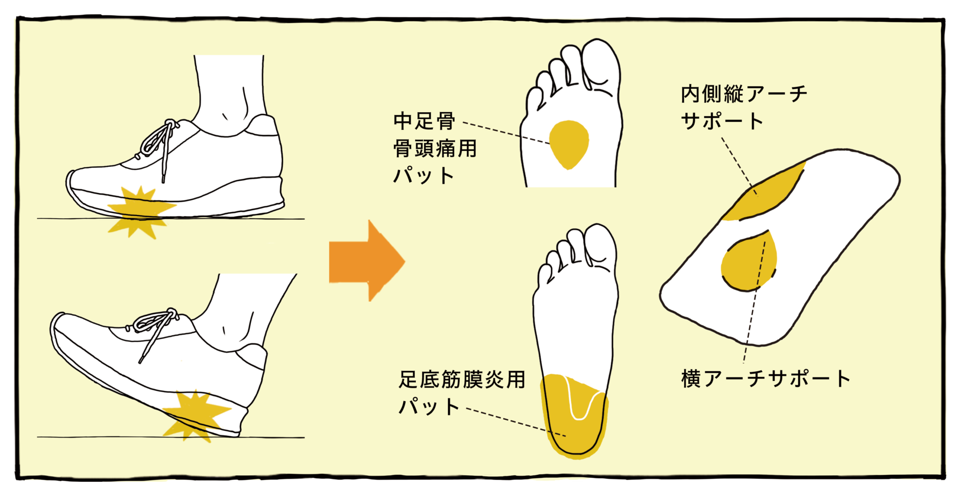 足裏痛対処法 旅先で足裏が痛くなったら 足のお悩み百科