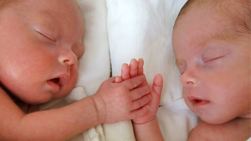 El Extrano Caso De La Bebe Colombiana Que Nacio Embarazada Con El Feto De Su Hermano Gemelo c News Mundo