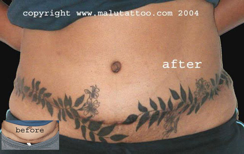 cover up tattoos. tuck scar cover-up tattoo