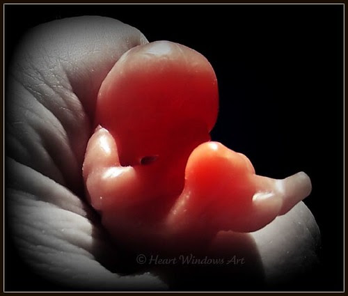 PHOTOS OF ABORTED BABIES