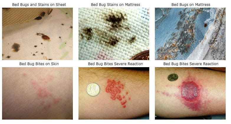 BED BUGS | Health information | Pinterest