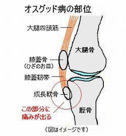 オスグット病 和歌山市 和歌山自然整体 スポーツ研究所