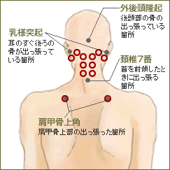 かわしま整骨院 歪みチェック