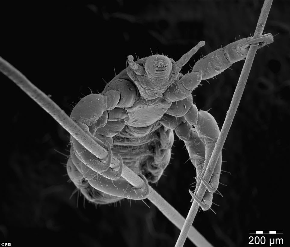 A microscopic image of a head lice gripping onto two human hairs. It was the May winner in 'The Human Body' category